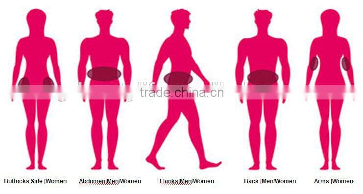 hot sale criolipolise machine