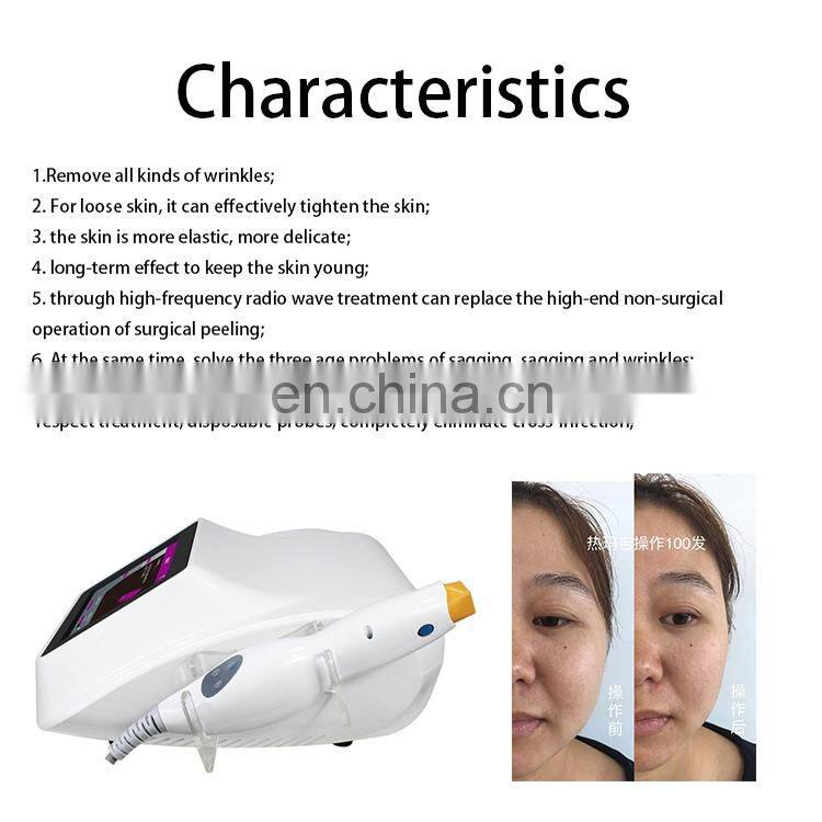 portable mini intragen FLX rf skin tightening Face Lift Stationary cpt newest Radio Frequency Equipment Machine