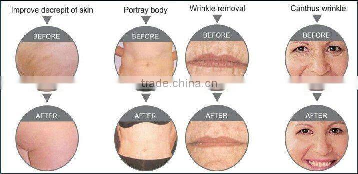 slimming machines cavitation rf factory manufacturer AYJ-T05