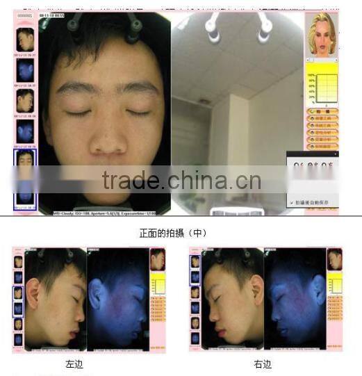 Excellent results!! skin scope analyzer, facial skin scope analyzer, skin scope magic mirror analyzer