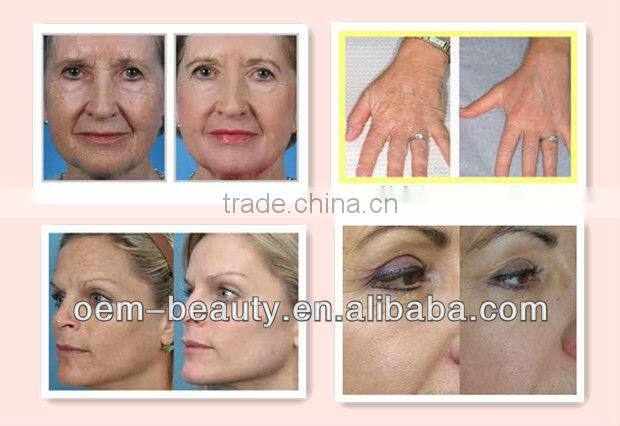 Best selling! 12 needles multifunctional derma roller for sale