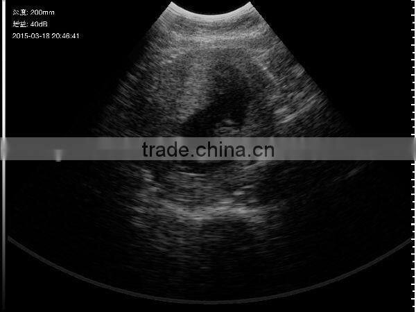 UProbe-1 Wireless Probe Ultrasound Scanner