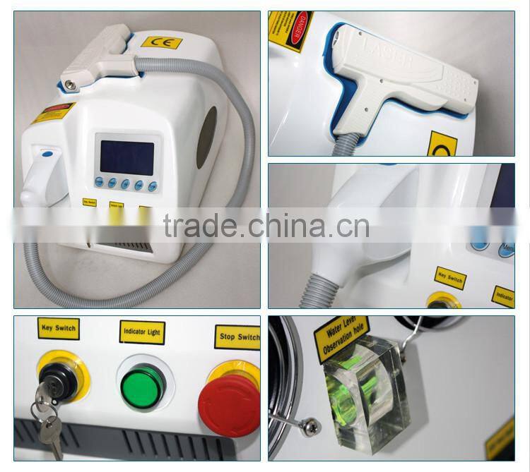 newest 1064nm & 532nm q switched lasers tattoo removal machine