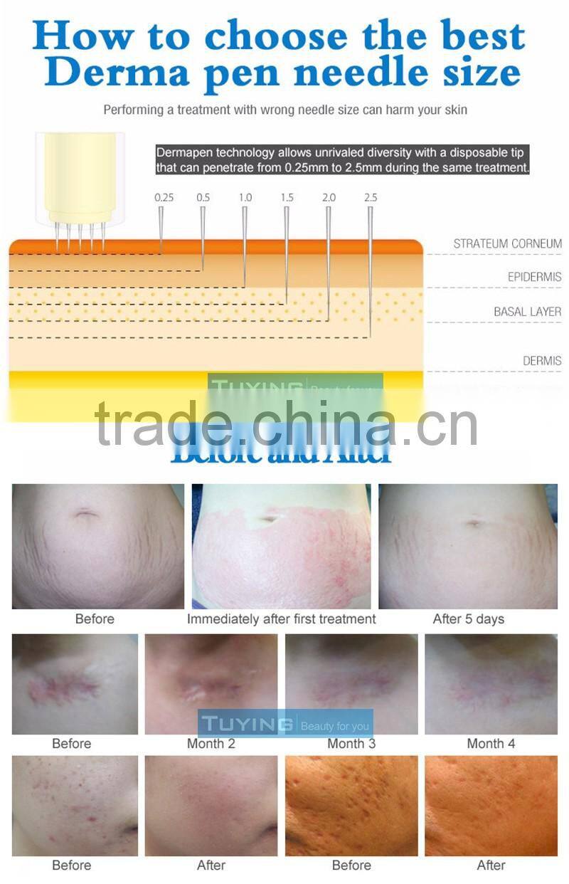2016 Auto Microneedle Derma Pen for skin care