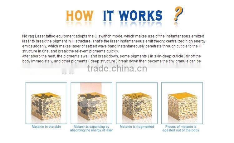 Christmas promotion 2000mj big power q switch nd yag laser