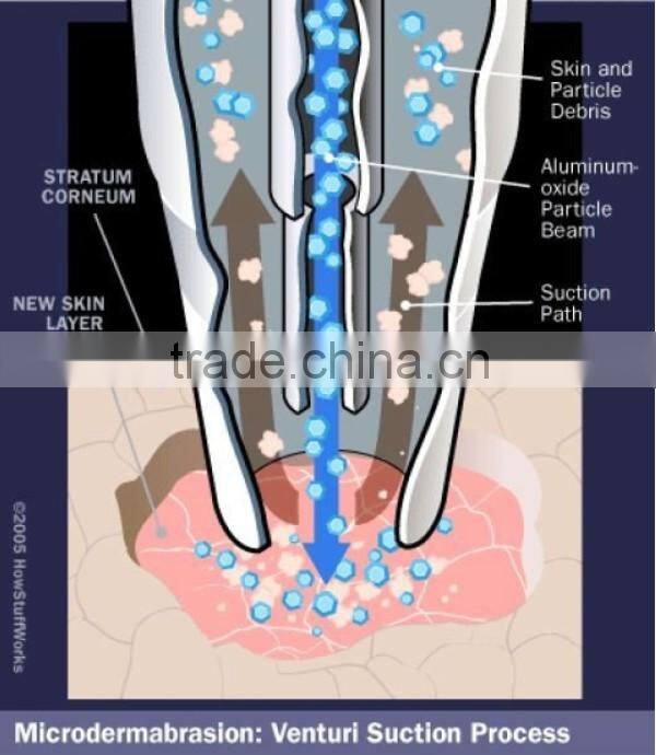 NL-DIA201 BEST! crystal peeling machine/crystal powder microdermabrasion(CE)