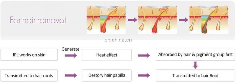 2017 update IPL beauty device 3 in 1 functions replaceable lamp 350000 shots hair remover depilation at home for machine