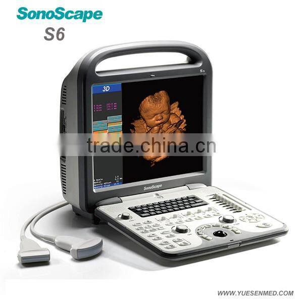 Mobile color Doppler system 3D 4D S11 Sonoscape echography