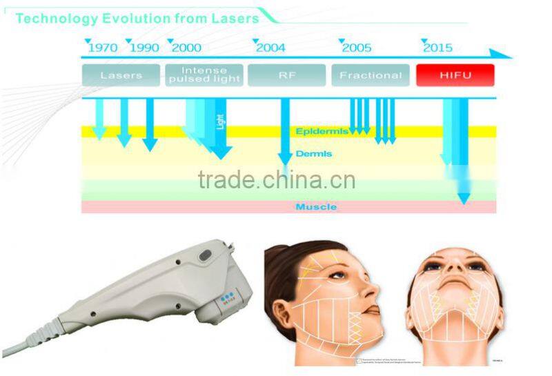 our company want distributor F2 ultra lift hifu