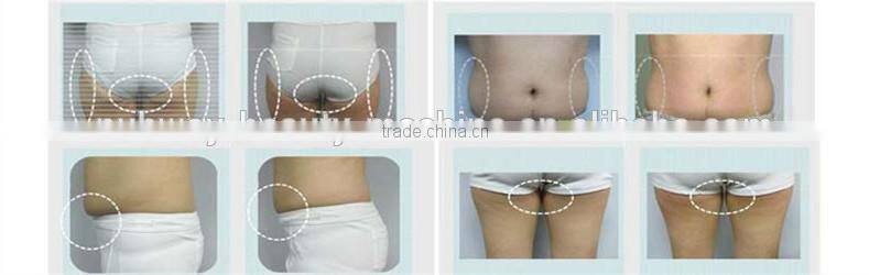cryolipolysis fast slimming beautiful instrument buy cryolipolysis machine