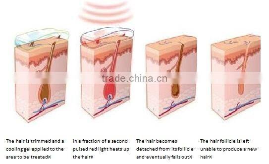 mini ipl laser hair removal machine home use,portable painless shr ipl hair removal,body hair removal shr ipl