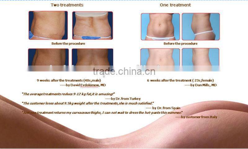 Newest cryo handle working cold lipolysis lipo laser fat loss machine for salon use