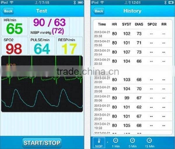 wrist ECG monitor