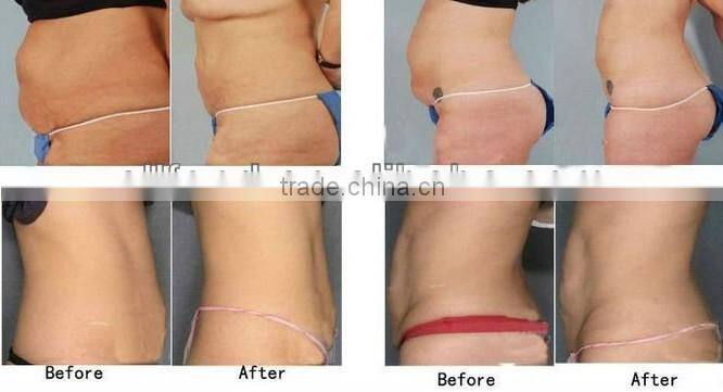 laser fat loss machine with strong laser 6 pads with touch screen
