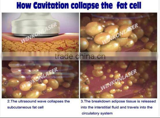 vacuum cavitation rf machine / rf cavitation / ultrasonic cavitation