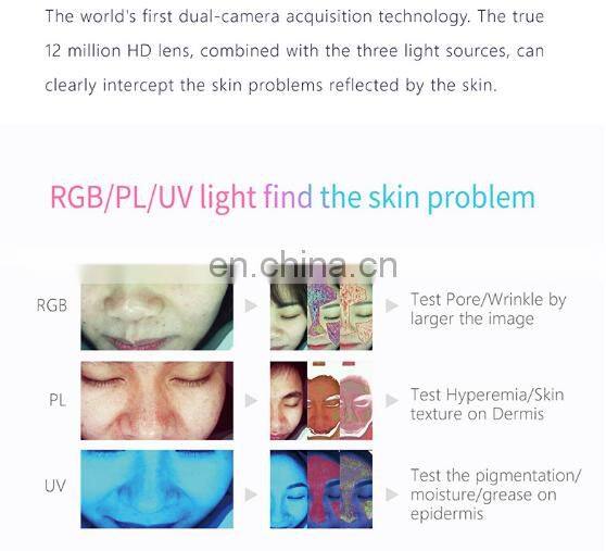 Newest Multi-languages Auto-analysis 10 Mega Pixels Beauty Skin Moisture Analyzer