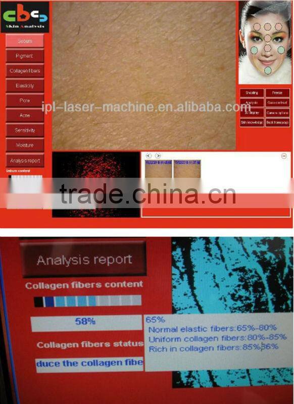 CE approved professional digital skin analyzer