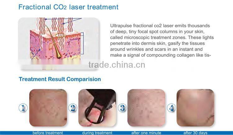 Factory direct sales CE FDA approved 7 hinged joint arm best co2 fractional laser peel machine