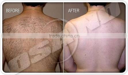 Portable IPL SHR remove unwanted hair permanently IPL Beauty Machine