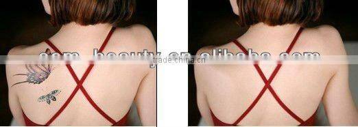ND YAG Q switched laser,laser tattoo removal machine best sell in 2015 -D006