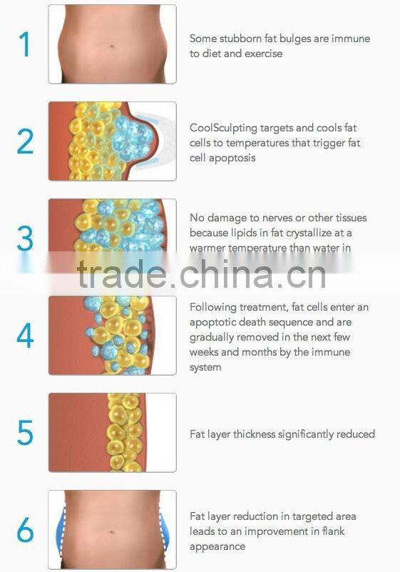 GLM HOT SALE RF cavitation cooling head Machine with antifreeze membranes