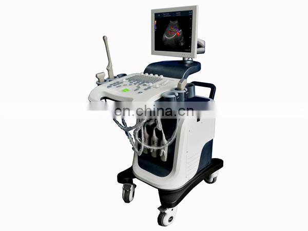 Full Digital Color Ultrasound Diagnostic System
