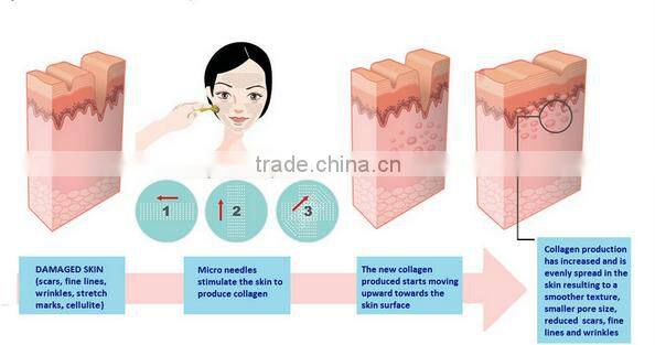 CE and RoHS korea Titanium 300&720 &1200 pins Bionic galvanic Skin nurse wrinkles eliminate derma roller