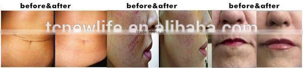 NL-DRS301S biogenesis dns derma roller 3 in 1 with 180/600/1200 pins (CE)