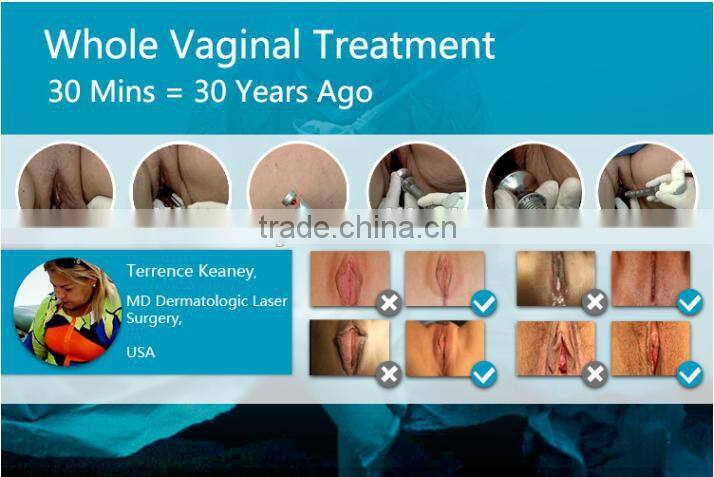 Vagina Skin Tightening Co2 Laser