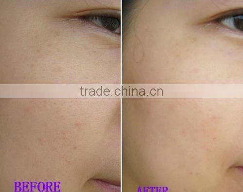 Factory OEM eye mask facial mask foot mask