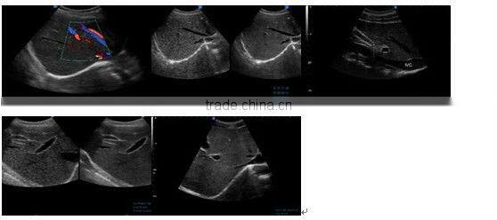 3D and 4D Color Doppler with 4D Real Time Live Probe iSpark 480plus/option Trans-vaginal Array Probe (180)