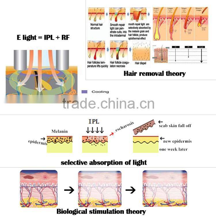2016 hot promotion ipl pigment fast removal electric hair removal
