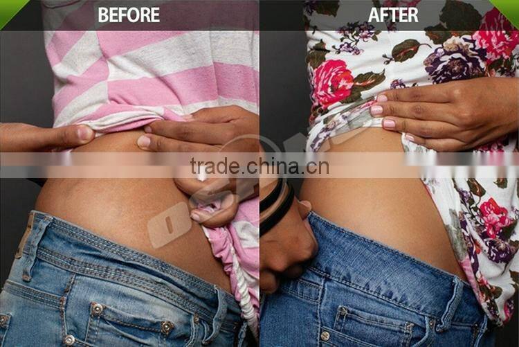 Ultrasound Fat Burning Machine/Fat Cavitation Device For Home