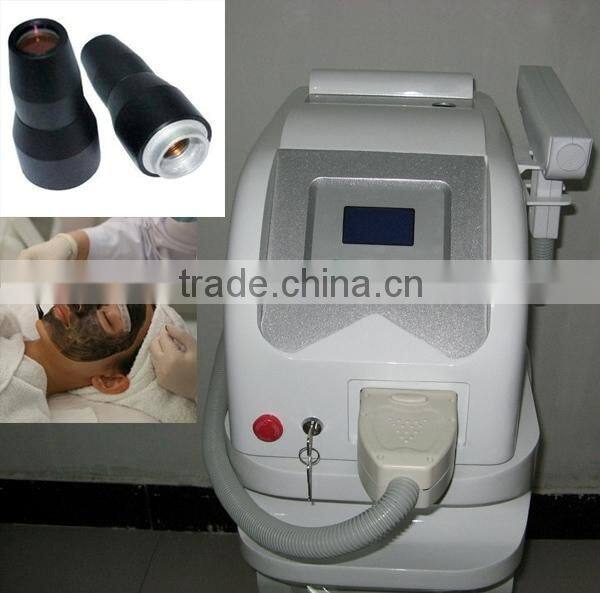 yag laser /lutronic spectra laser/laser for pigmentation removal,tatoo removal