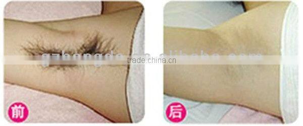 Permanent hair removal machines for skin rejuvenation beauty machine BD-J005