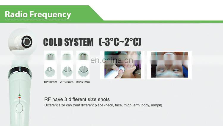 Hot Sale 2 in 1 rf + ipl laser Hair Removal Beauty Machine With Reasonable Price