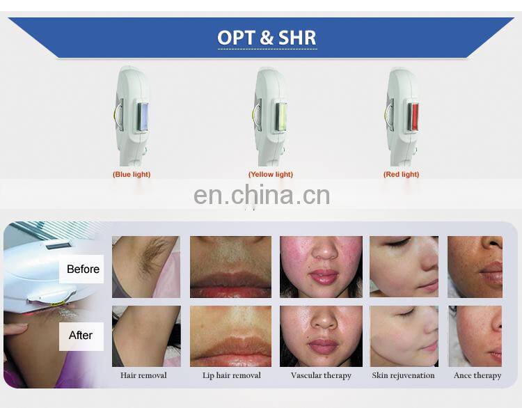 3 in 1 multifunction beauty machine with opt/ nd yag laser/rf lifting