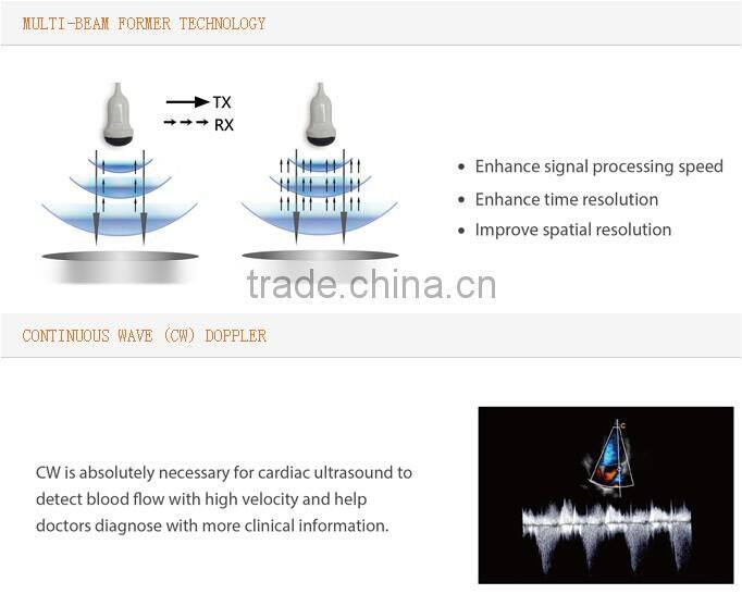 New Trolley 3D/4D Color Doppler Ultrasound Diagnostic System I3