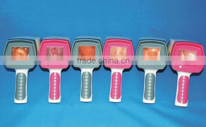 Digital Video Colposcope, Laptop Video Colposcope, Gynecology Video Colposcope
