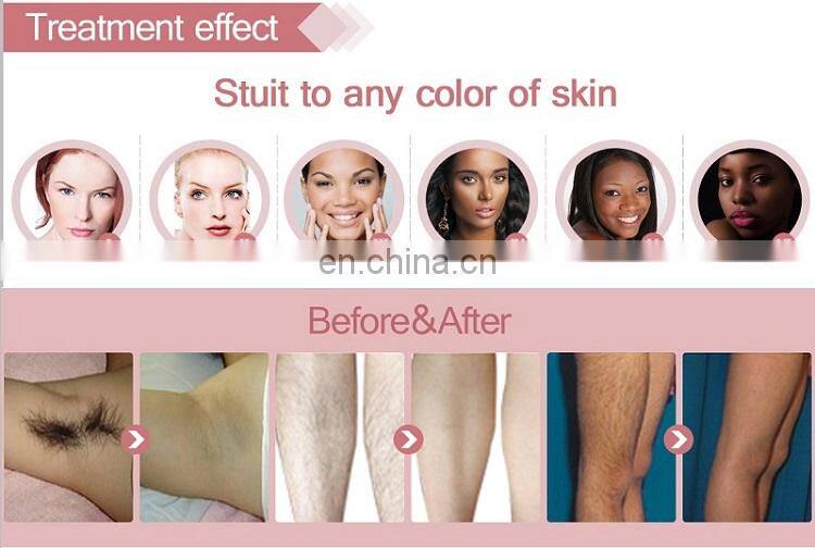 2020 Professional 808nm Diode Laser Vertical Hair Removal Equipment