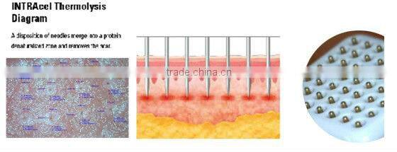 2 professional treatment handles radiofrecuencia fraccionada