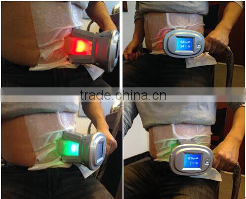 hot sale criolipolise machine