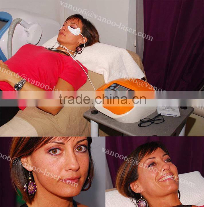 *2016 Portable RF eye care machine/collagen eye gel/eye slag/ eye bag/ eye skin lifting/skin tightening/home use machine