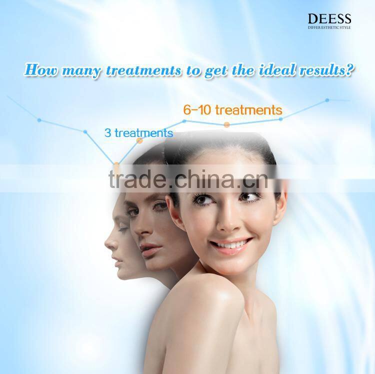 300,000 shots long lifetime ipl hair depilation device permanent hair removal at home epilator body hair removal cream