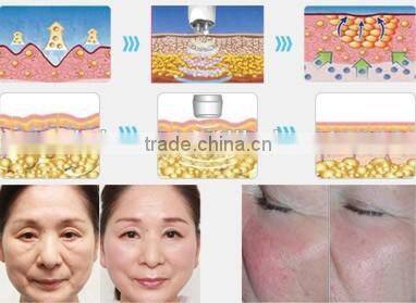 **** 40KHz RF Vacuum Cavitation Slimming Machine Multipolar For Belly Slimming / Face Lifting