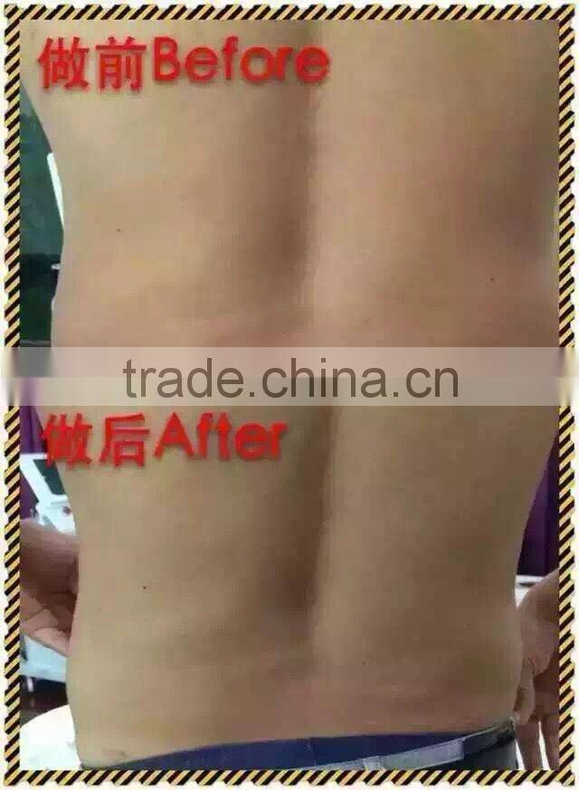 distributor wanted hot selling beauty equipment body shaping hifu