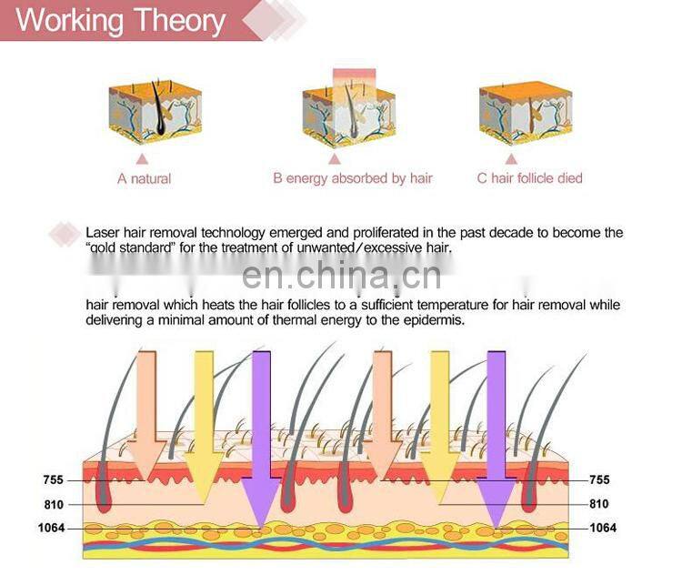2020 Professional 808nm Diode Laser Vertical Hair Removal Equipment