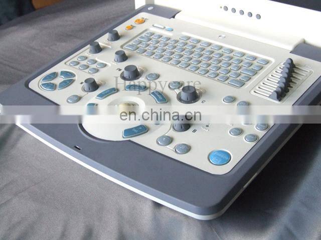 HC-A013 Medical 15 inch LCD color Doppler 2D ultrasound machine Laptop ultrasound scanner with linear probe