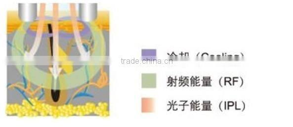 spa use portable ipl skin rejuvenation mini home hair removal ipl 2014