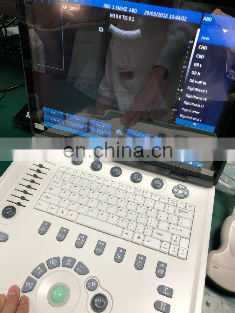 Medical diagnostic system cheaper Portable BW 3D 4D Live ultrasound Scanner Machine